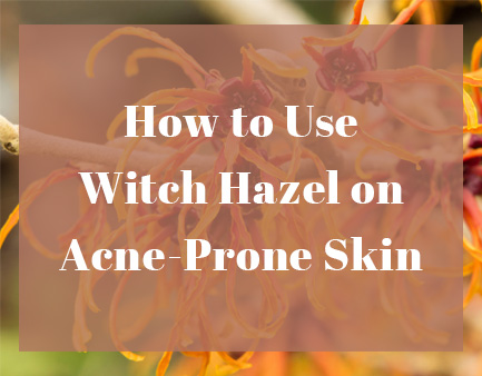 How to Use Witch Hazel on Acne-Prone Skin